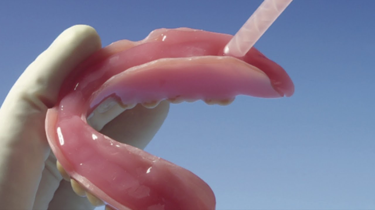 Overview on Partial Dentures